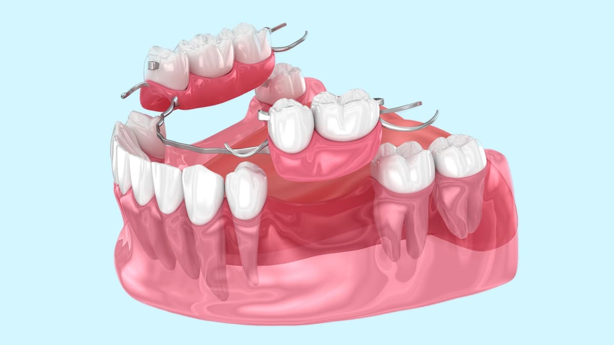 Dentures