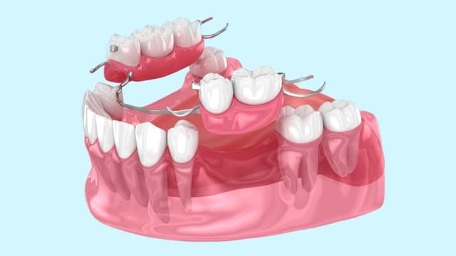 Dentures