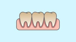 Discoloured Teeth